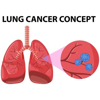 肺癌世界哮喘日禁烟日肺健康禁烟矢量图